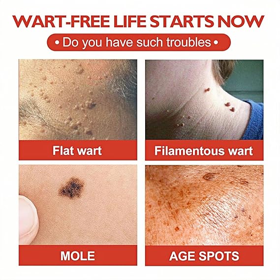 Skin Tag And Acne Remover Patch (144 Pcs) | مايكرو باتش بر